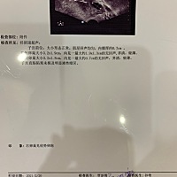 姊妹们帮我看看我的卵泡今天下午刚检测的我什么时候才能排卵什么时候同房才容易怀孕呢！
