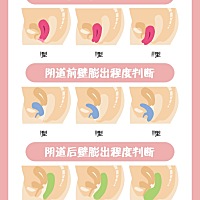 产后42天要到医院进行的评估和检查 很多宝妈表示，在怀孕中晚期的时候，就常常出现咳嗽🤮、打喷嚏🤥...