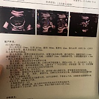 从怀孕就觉得是男宝宝 不知道直觉准不准