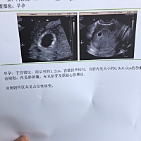 1.21号月经开始.26号结束。29和30同房。1.7号和10同房。3.1号孕囊0.9✖️0.6有卵黄囊了。想知道到底是哪...