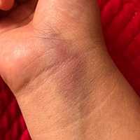 我是聋哑人，男方也是聋哑人，我孩子是正常人。 刚开始认识我不愿意和他处，都已经分开了，他又来找我，...