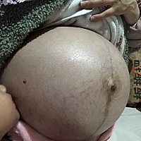 都40周➕1了。除了假性宫缩。往下坠痛。什么反应都没有。你要什么时候才发动了。宝宝
