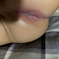 冬宝最近老是红屁股……给他涂了护臀霜，给他凉凉，看着好心疼，用的帮宝适一级帮，感觉以后要给他用沐...