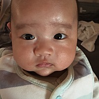 湿疹反反复复的，快三个月了，满月的乙肝疫苗还没大