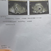 女儿才刚刚一岁多，又怀孕了，而且测出是儿子，好纠结要还是不要啊。要自己累女儿可怜，不要又怕后悔遗...