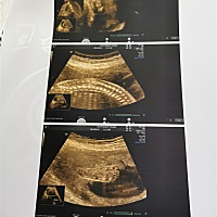 大宝男孩刘昱辰  二胎中，已知女宝   大家帮忙想想什么名字比较好呢