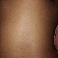 宝宝八个月。背后长了很多红的小点点    该怎么办？