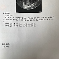 大姨妈干净10天后检测不到卵泡正常吗？这个月还有希望吗？ 3月7日来大姨妈，3月11号大姨妈走了，今天3月...