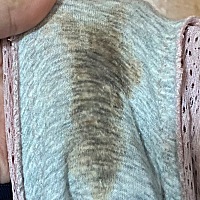孕38天 这个分泌物正常吗？