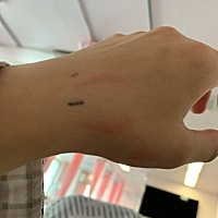 今天早上凌晨4点羊水破了  5.00赶到医院  11.00开了三指推进待产房等待打无痛针  12.00开了六指打上无痛...