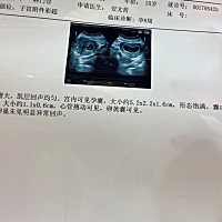 怎么看孕囊，有知道的宝妈吗？告知下，谢谢！现在孕吐反应很厉害，想知道你们都是怎么缓解孕吐的🙏