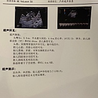 二胎啦，谁会看这是男孩女孩呀，好奇