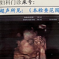 四维彩超and宝宝本人对照，像吗？