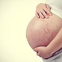 相信有很多妈妈孕晚期都成了花肚皮，还伴随不同程度的皮肤瘙痒，皮肤也粗糙起来。孕6个月后出现皮肤瘙痒...