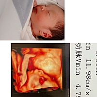 刚照四维的时候 觉得好丑啊，都要丑哭了  出生后觉得还是蛮可爱的😅😅 已生的宝妈 有没有同样像的呀...