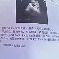 六个周，听朋友说看孕囊大小能分辨男宝女宝真的假哒