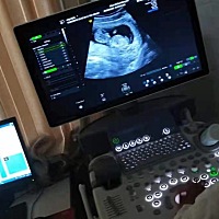 找她看的单子，也看了一下，不错！闺女的衣服，名字，用的所有东西都可以准备了