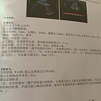 非常好的28周b超呢～大家产检得怎么样了？