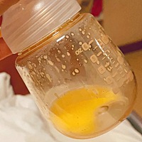 出生第二天吸出的少量母乳 身边人说这是黄金奶 不是所有产妇都会有 是这样吗？