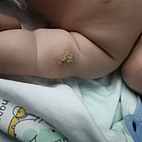 育苗的针眼这样的粑粑正常不，好吓人呀