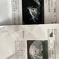 一胎二胎形状不一样，有懂的宝妈吗