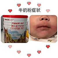 出生的头两天喝的是蓝臻，之后是喝母乳，然后快满月的时候堵奶我发烧了，又喝了一个星期的羊奶粉（什么...