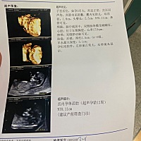 今天nt过啦[偷笑]有没有宝妈帮忙看看男孩👦女孩👧 纯属娱乐[酷]