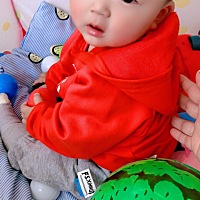 宝宝脸上出小疙瘩，是怎么回事。抹点什么比较好？