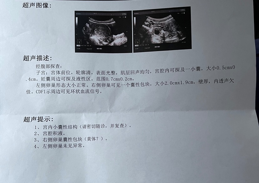 4.20末次月经，5.10号排卵，期间hcg值翻倍不好，孕酮也一直降，6.8号怕宫外孕来医院做b超，请问能排除宫外孕吗？