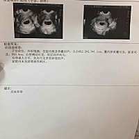 请问各位专业人士，这多少天？？？