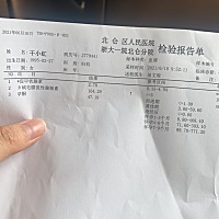 早期有种来姨妈的疼 白带多