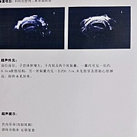 下午去确认居然是双胎，自己还天天测