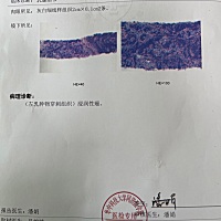 90后单亲妈妈乳腺ai调理之路 感谢各位宝妈的关心，既然大家都这么想了解，我就索性一下发出来吧