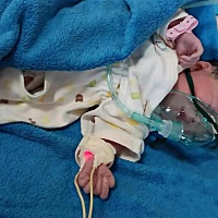 报喜啦！7.13剖腹产五斤小仙女，37＋5，白白嫩嫩惹人爱！