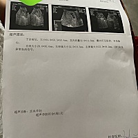 有经验的宝妈看一下
