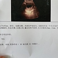 希望你们健康成长 💤💤💤💤💤💤
