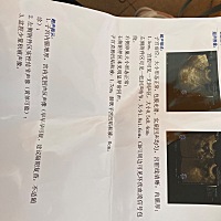 帮忙看看这是怀没怀？可疑是不确定？