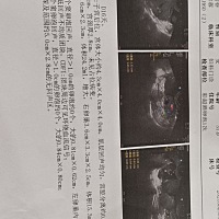 这个有没有可能怀孕呢？