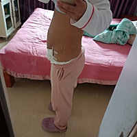 你们恢复的怎么样