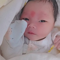 女宝，40 4出生，6斤3两，双顶径-股骨长从来不大于二，肾盂无分离