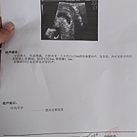有懂的宝妈帮忙看看是男是女