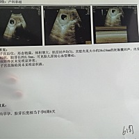 承接明年的虎宝宝🐯🐯🐯