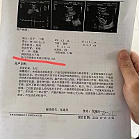 唉……医生说的好吓人，请问这样正常吗？你们有没有这种情况呢？