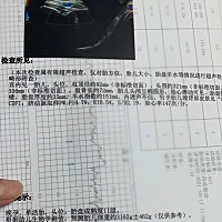 弱弱的问句，超预产期宝宝还没出来，是不是可以催产和剖腹两个选择😣😣😣不想剖腹怕痛怕死了