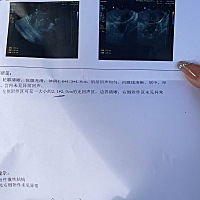 一个人无奈了，18号同房了，今天老公不在身边，医生建议同房😪😪