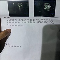 这样的卵泡正常吗？可以排卵吗