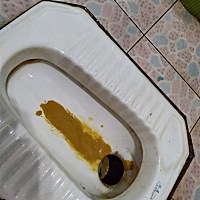 宝宝这样子是拉肚子吗？