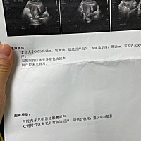 一深一浅、可是B超没有、什么情况、帮我看看