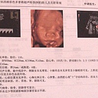 麻烦大家帮忙看看这个是男孩还是女孩？谢谢