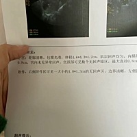 这种白带是排卵了吗？